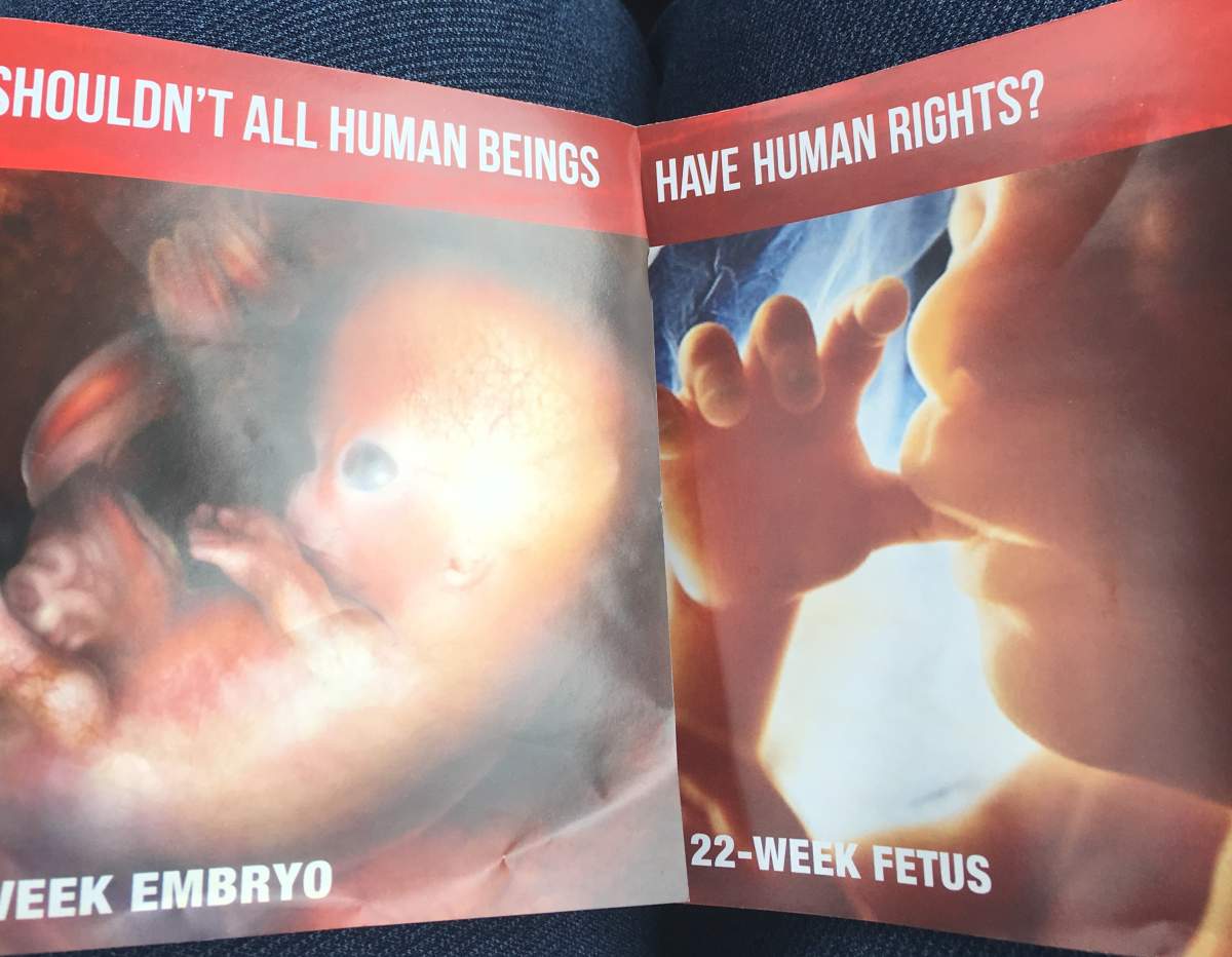 The front and back page of the flyer show a fetus in the womb. The inside pages show graphic images of dismembered fetuses.