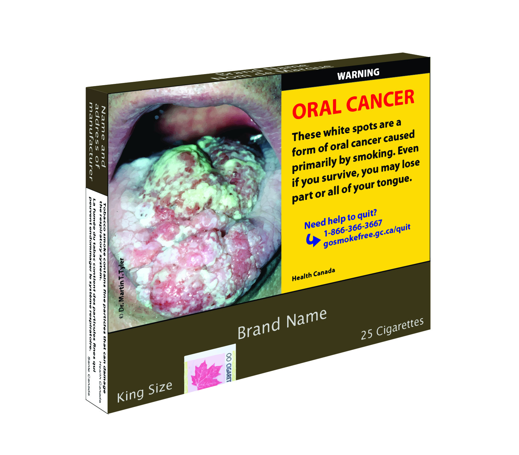 cigarette packages in canada Here's what cigarette packages could soon look like in Canada - National