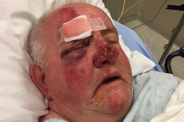 Lindsay Hanes says her father Roy Gunter was the victim of a hit and run in Peterborough on June 2.