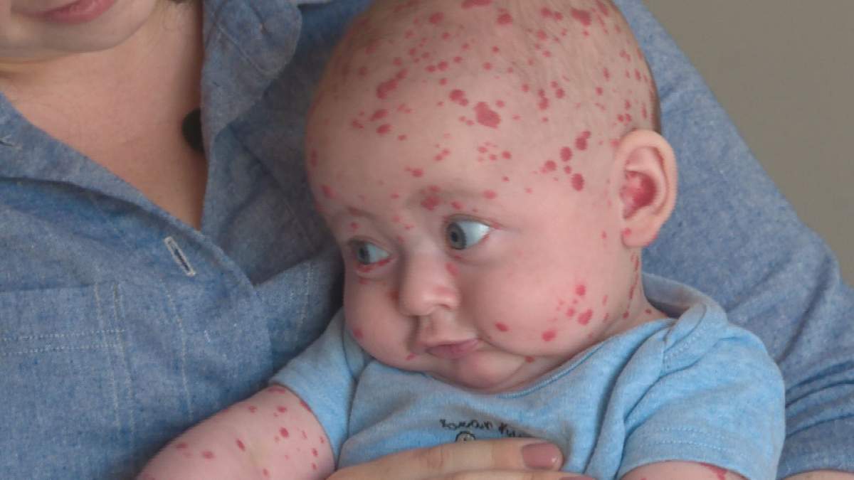 Dominic Wight smiles as his mother Meagan cradles him.