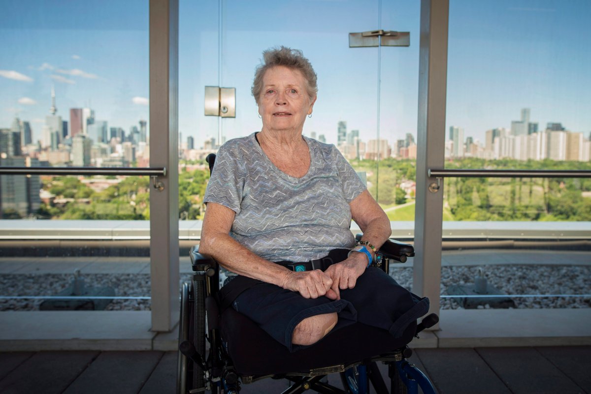 Beverly Smith, a survivor of the Yonge Street van attack, poses for a photo on the rooftop patio at Bridgepoint Health in Toronto on Friday, July 6, 2018. 