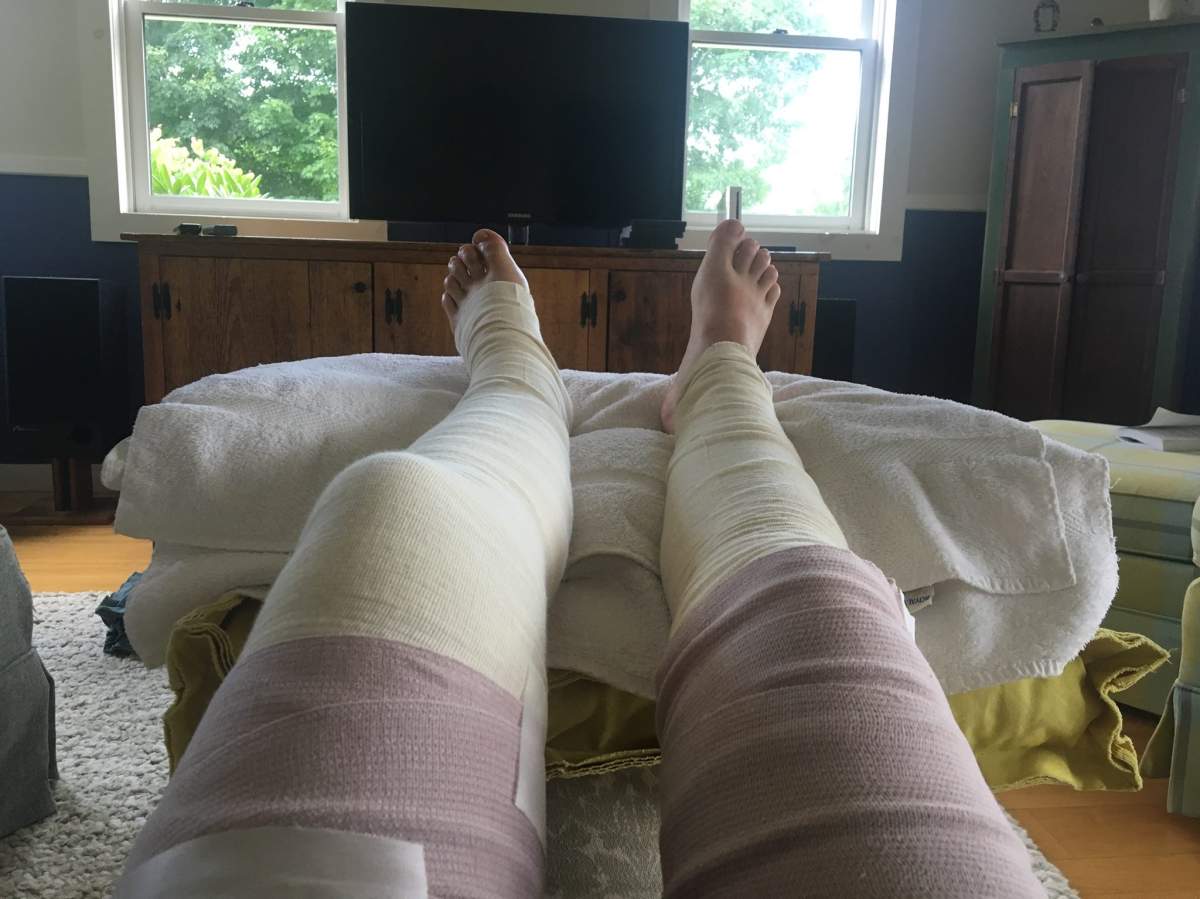 Murphy said she is still getting her wounds treated but is expected to make a full recovery.