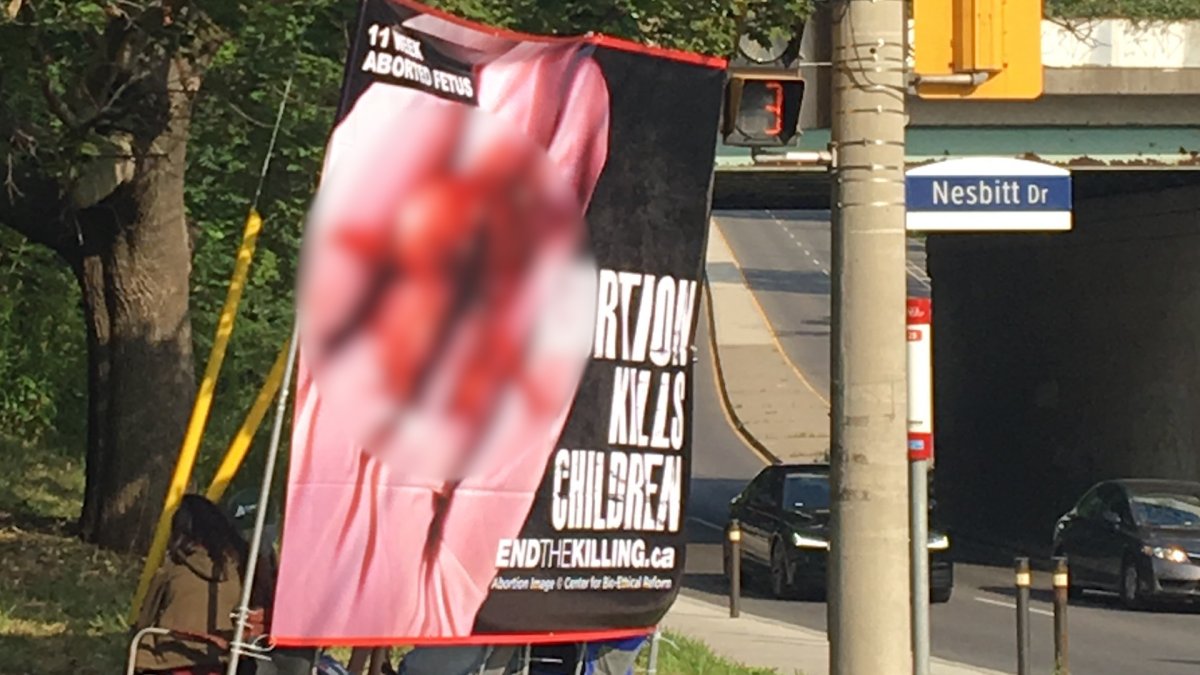 This graphic anti-abortion picture was seen just steps away from a children's park. How do we talk to children about abortions? .