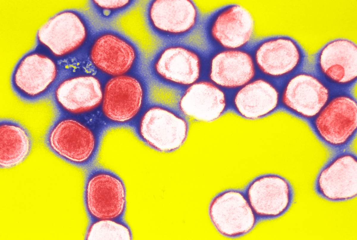 FILE -- Cowpox virus virions, used in the preparation of the smallpox vaccine. 