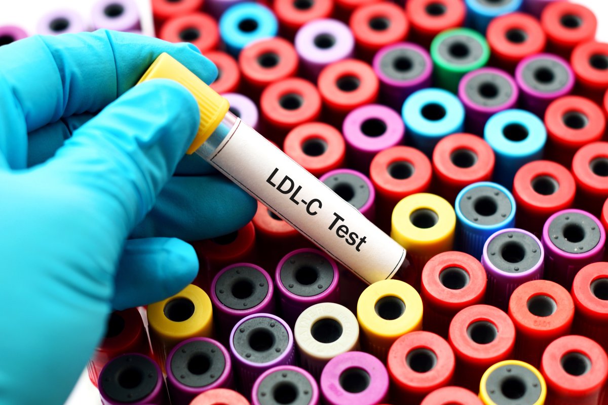 According to a new study, HDL cholesterol - often known as the "good" cholesterol - may not be good for everyone.
