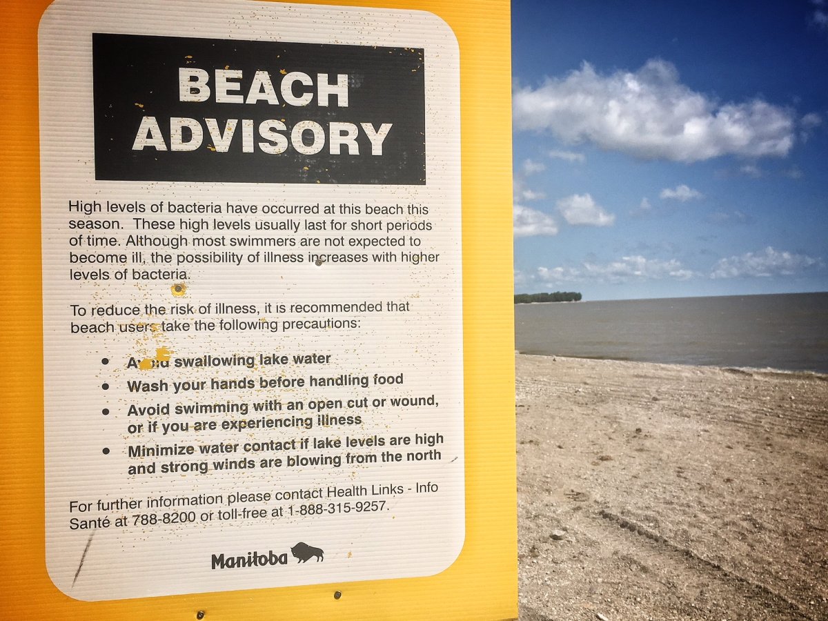 A sign on Gimli Beach warns people about possible high levels of bacteria.