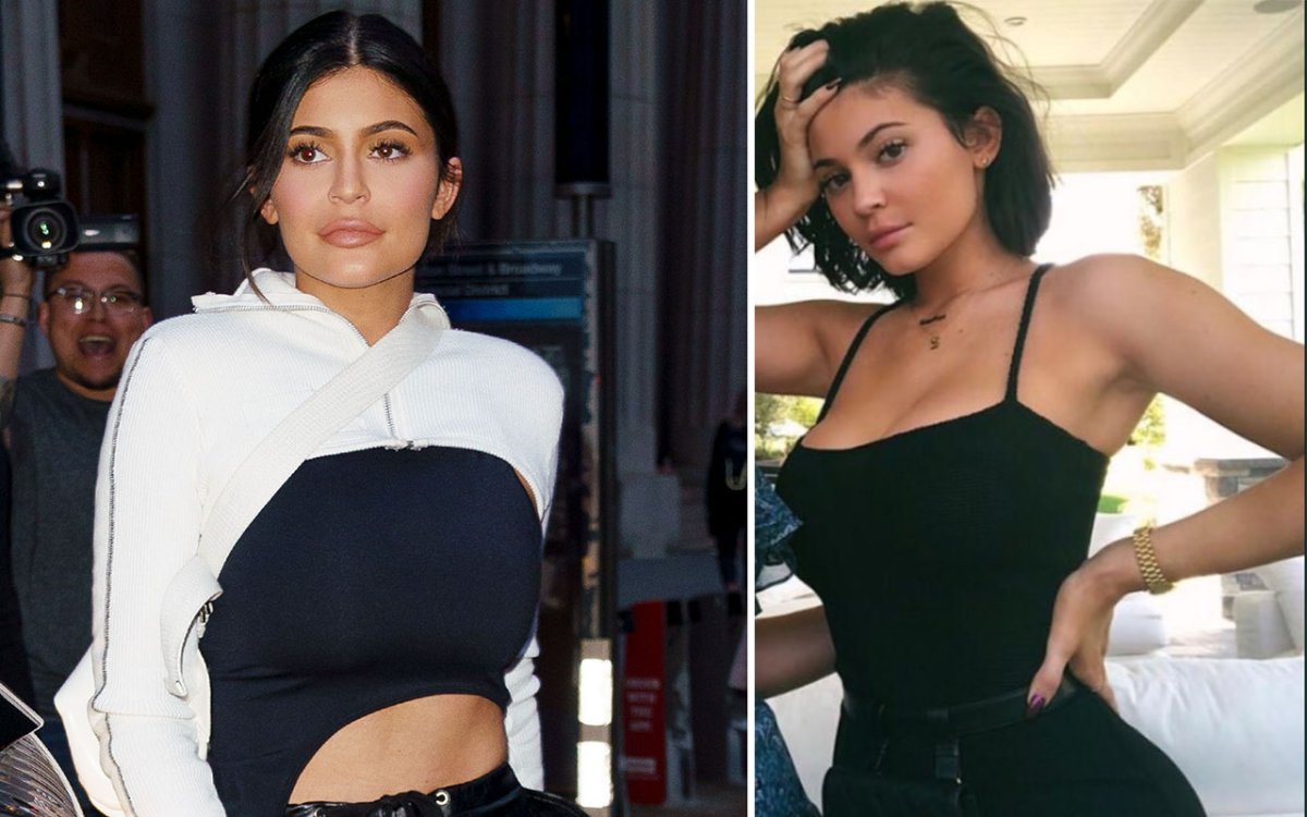 Comparison of Kylie Jenner's lip fillers from May 2018 and July 2018.