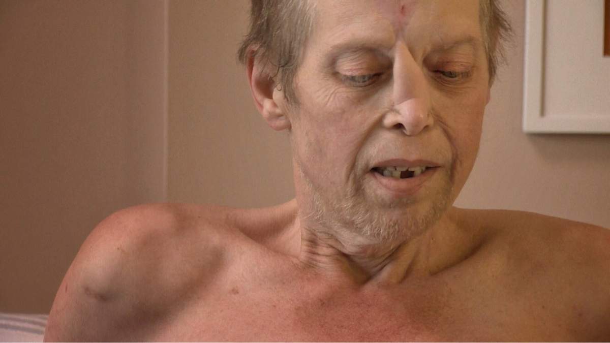 The CAMPP team cares for chroncially ill patients like Kevin.