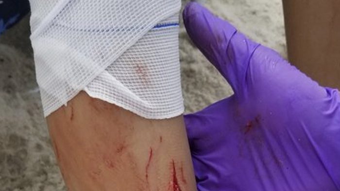 Sharks in New York?: Two children bitten by 'large fish' off Fire Island -  National