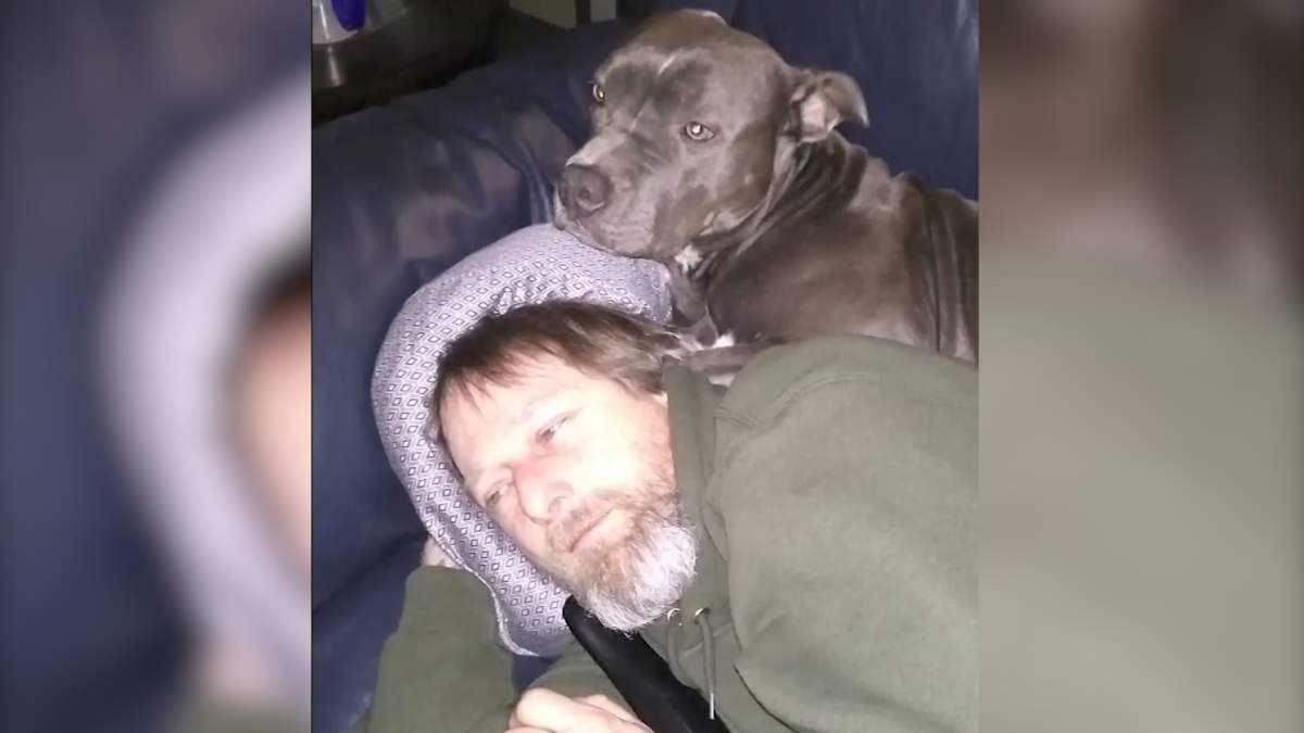 Dog owner’s limbs amputated after contracting rare infection from lick - image