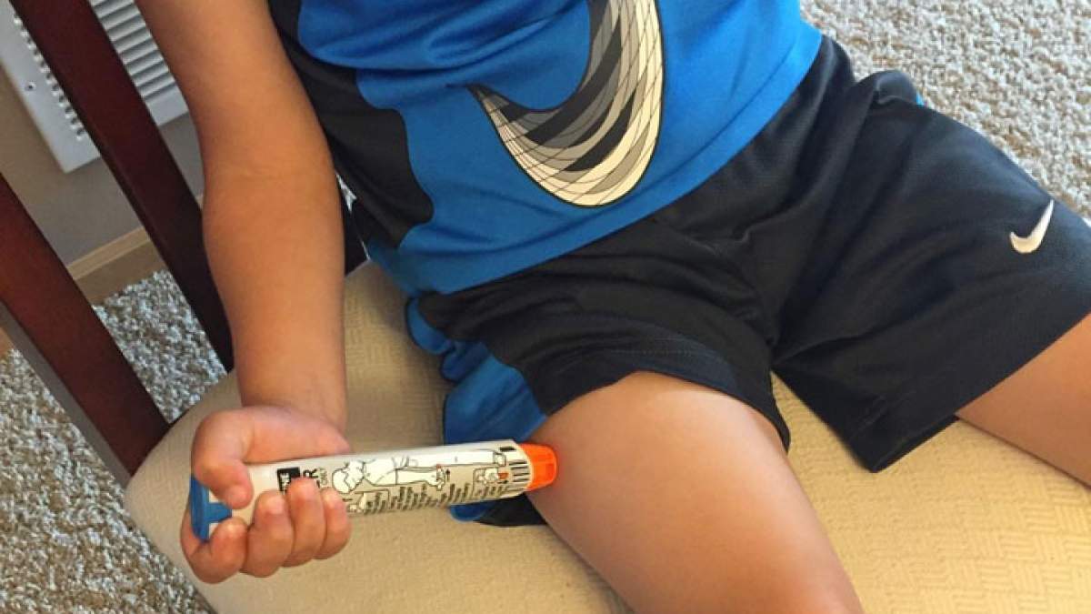 Food allergy education a must as kids head back to school, doctors say