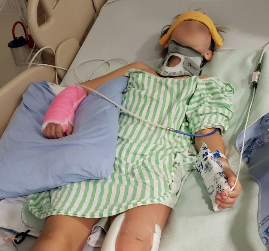 Chase suffered a broken leg, arm, wrist and fracture to the face.