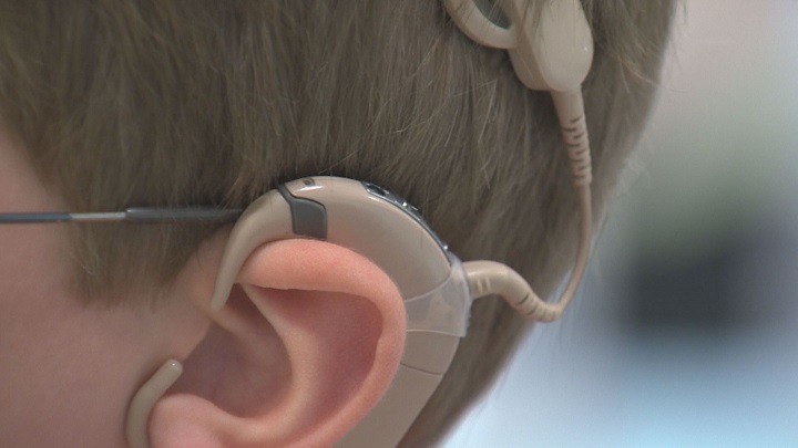 The 250th cochlear implant surgery in Manitoba was completed in June 2018.