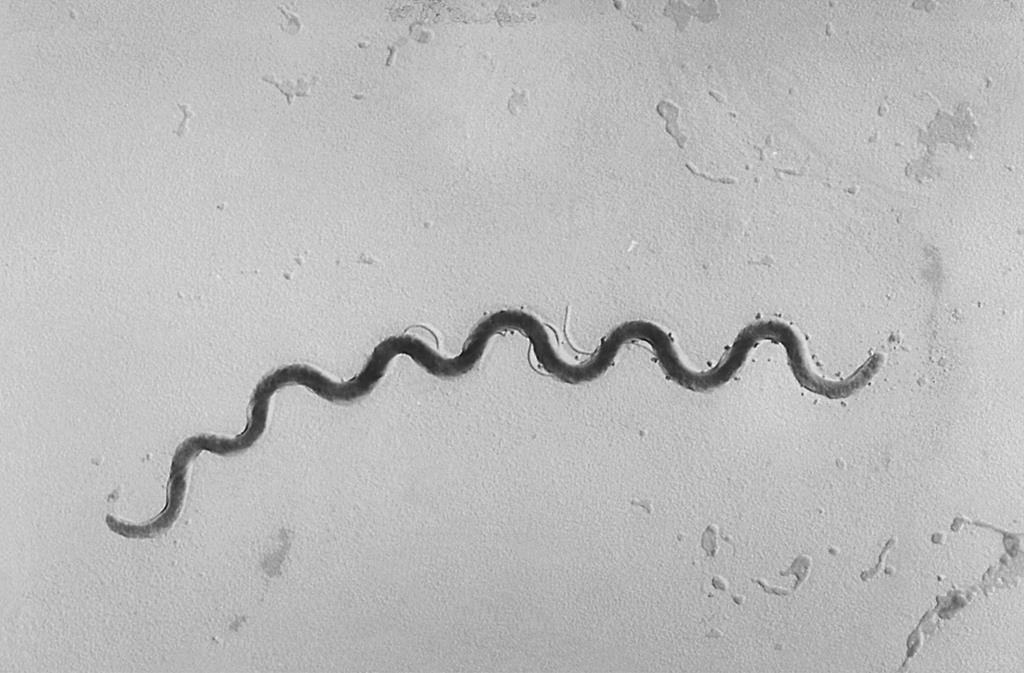 This 1972 microscope image provided by the Centers for Disease Control and Prevention shows a Treponema pallidum bacterium which causes the disease syphilis. A report released on Tuesday, Sept. 25, 2018, says that newborn syphilis infections are surging to the highest level in 20 years. (Susan Lindsley/CDC via AP).