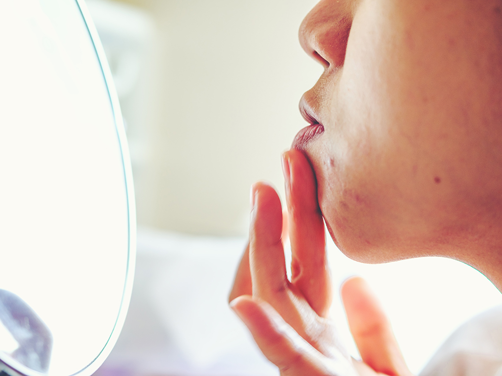 Pimples don't just appear on your face, chest and back. They can pop up in the oddest places, too. Here's how to handle them. 