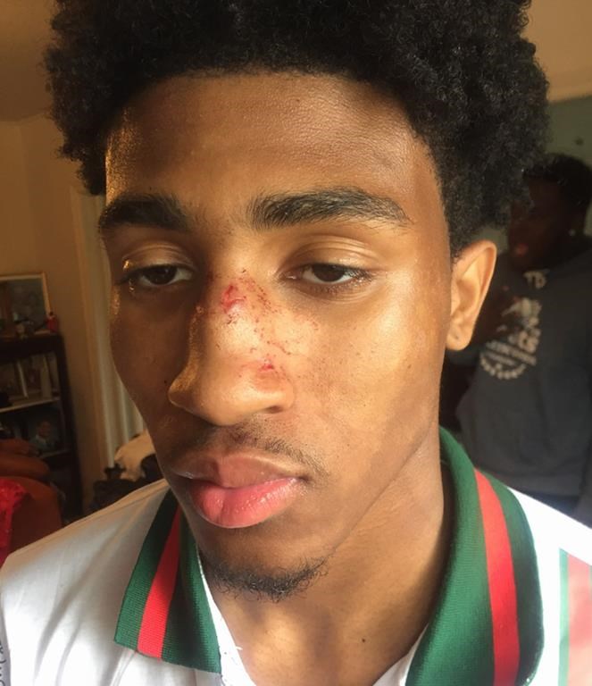 Cory Taylor is shown with injuries he claims were sustained after an altercation with the Halifax Regional Police in this undated handout photo.