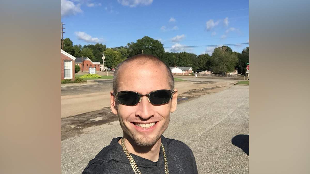 David Cowart takes a photo showing his new smile.