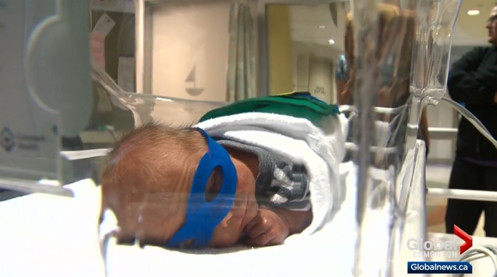 Lucas the Ninja Turtle was born 5 weeks early.