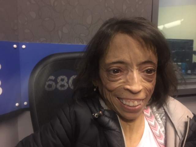 Rose Pallone has been receiving treatment at CancerCare Manitoba for 48 years. She told 680 CJOB the clinic is now too busy to serve all its patients. 