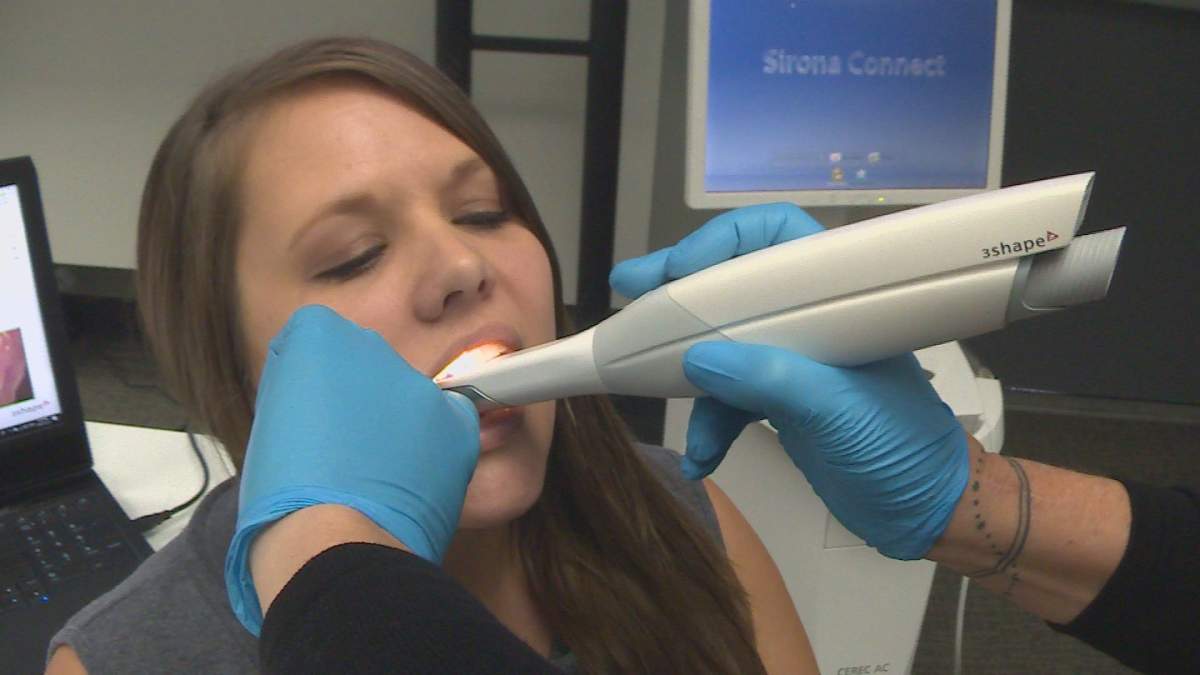 The 3D scan is sent to the Schell Dental Ceramics lab in Kelowna, where it\’s then used to create dental restorations.