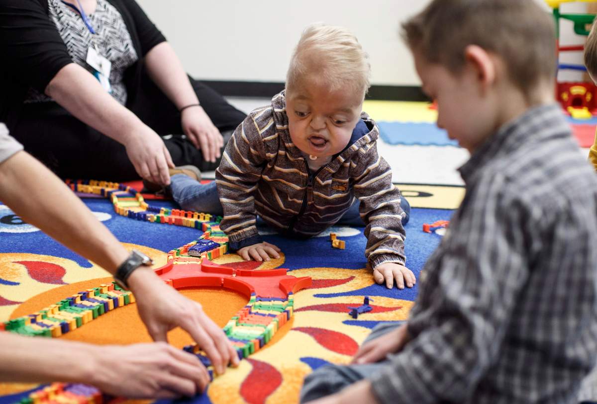 Porter Stanley plays at preschool in Onoway, Alta., on Wednesday, November 7, 2018. He is one of 30 people in the world to be diagnosed with Beare-Stevenson syndrome, a craniofacial disorder.