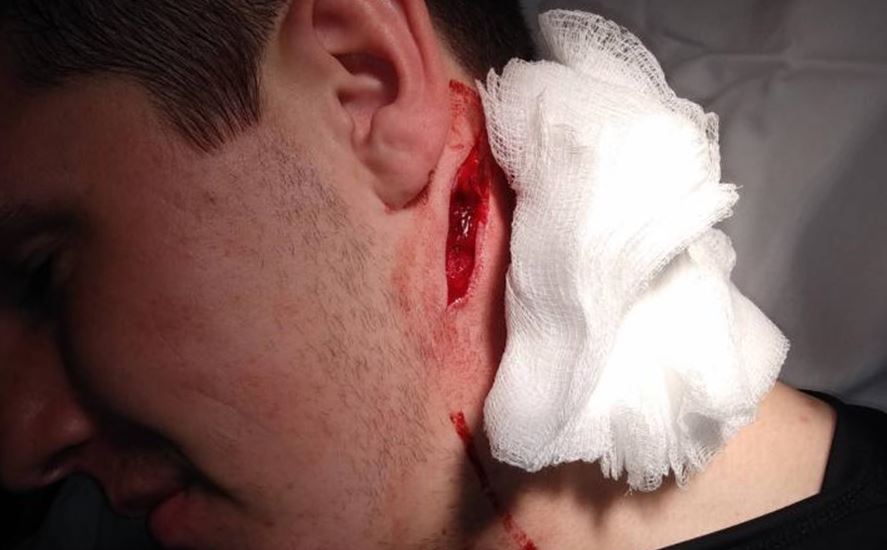 19-year-old Bailey Fraser suffered a potentially life-threatening injury when he was struck in the neck by a skate during a recent hockey game.