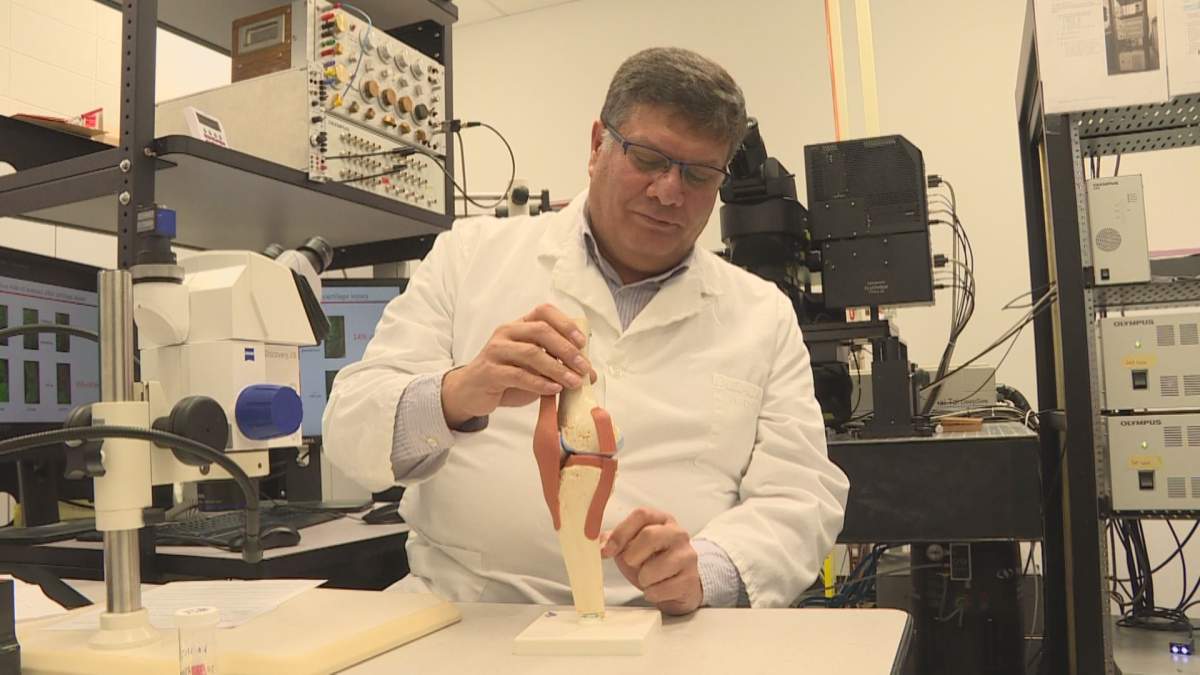 Dr. Ziad Abusara explains how removing the meniscus can lead to osteoarthritis .