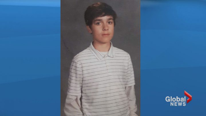 Riley Smith, 15, was severely burned by cooking oil in northwest Calgary on Saturday.