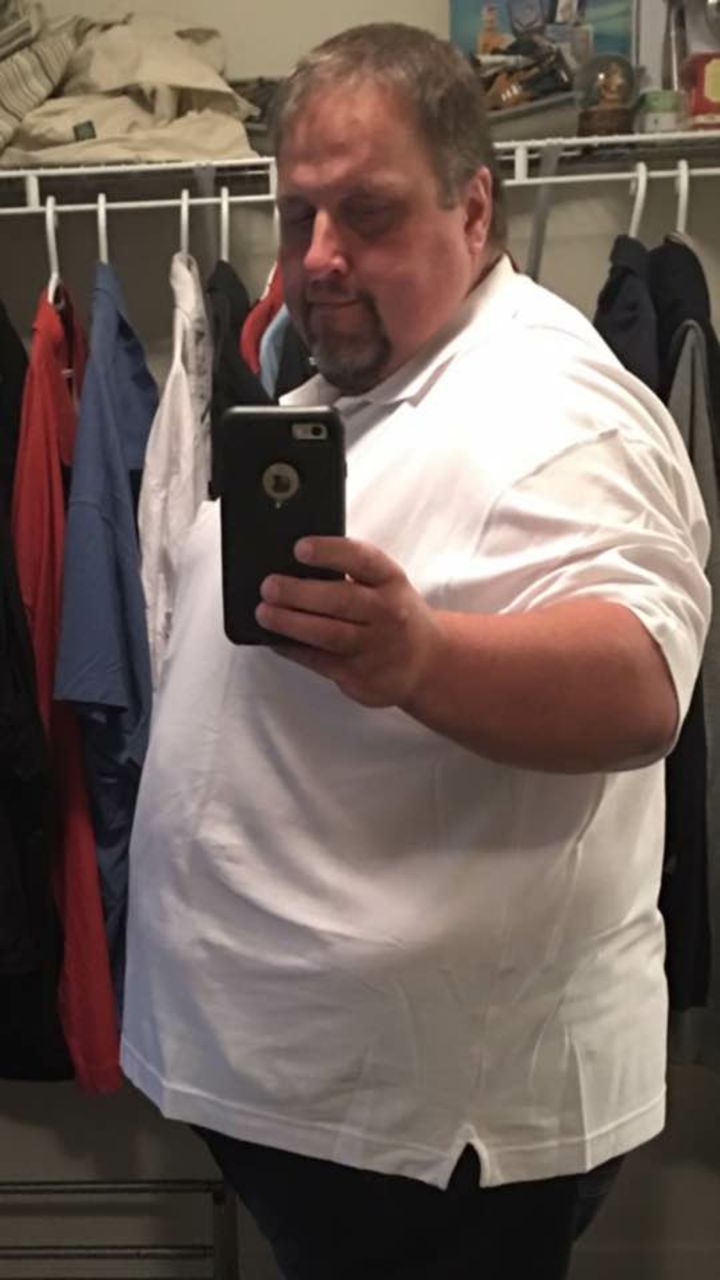 Tony Bussey has lost more than 300 pounds after being motivated and he credits his weight loss to his experience of being evacuated from Fort McMurray during the 2016 wildfires.