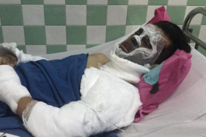 B.C. couple face long recovery after ‘life-changing’ acid attack in ...