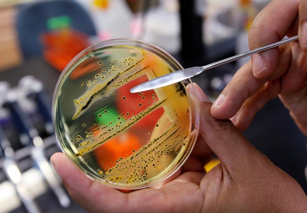 A doctor points out a growth of of salmonella in a petri dish at IEH Laboratories in Lake Forest Park, Wash., in this Monday, May 17, 2010 file photo. THE CANADIAN PRESS/AP/Elaine Thompson, file.