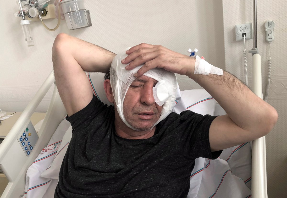 Yavuz Selim Demirag, a Turkish journalist critical of President Recep Tayyip Erdogan's government and its nationalist allies, rests in a hospital bed in Ankara, Turkey, Saturday, May 11, 2019.