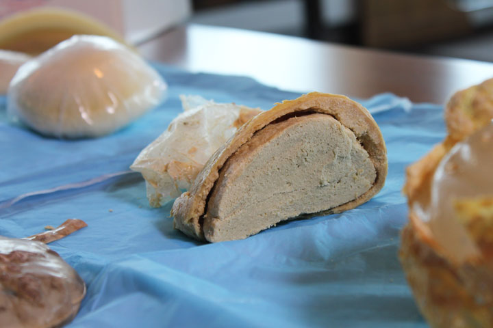 An early model of breast implant, made of foam.