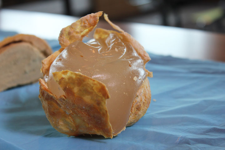 A breast implant, where the woman’s body developed a hard shell around it, according to Pierre Blais.