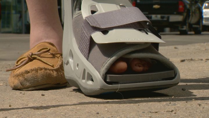 Reanna Price, 15, fractured her big toe after her left foot was run over by a Regina transit bus Wednesday morning.