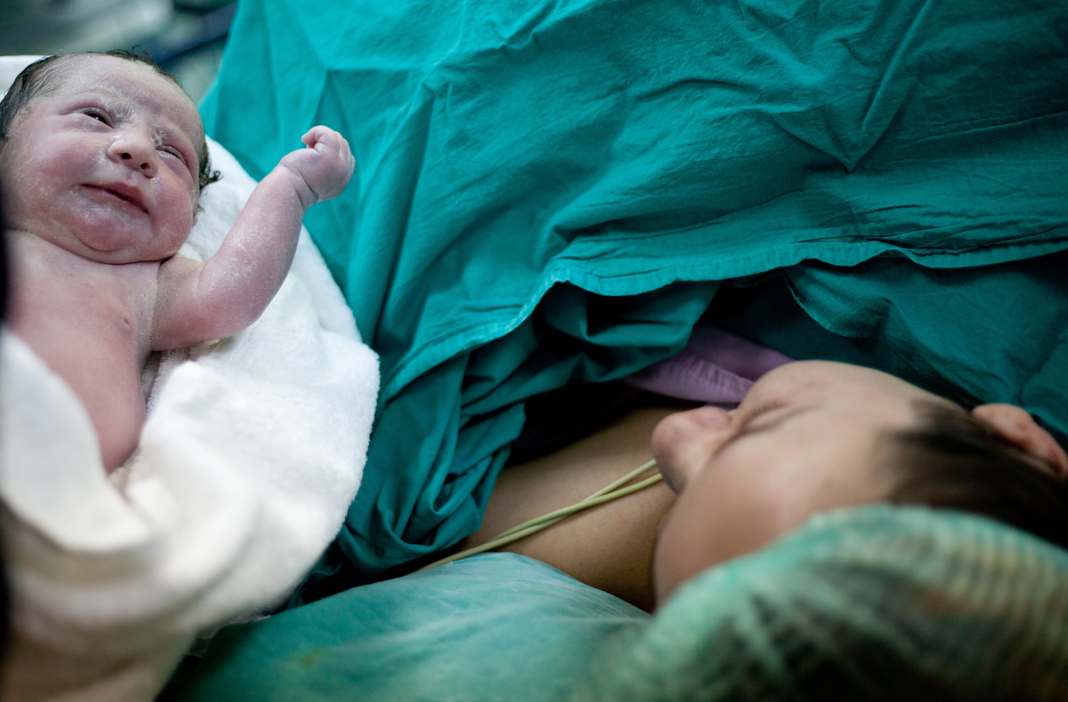 Why is the C-section rate still climbing in Canada?