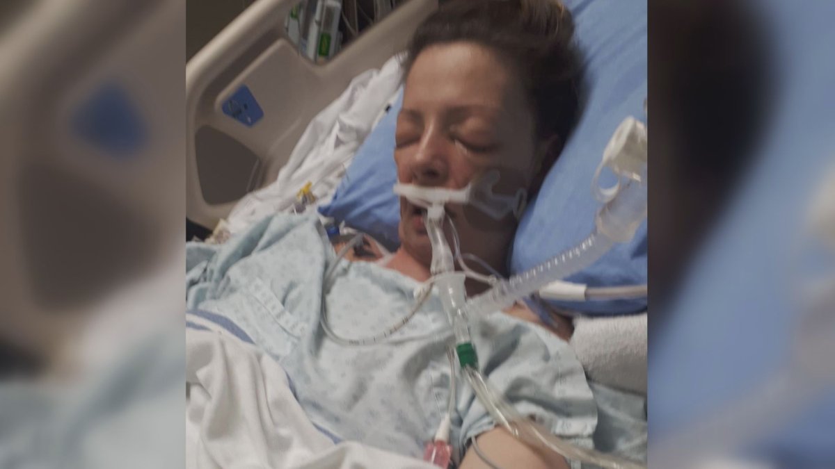 Nevada Cunnington was put into a medically induced coma for 15-days after catching the H1N1 flu virus in December.