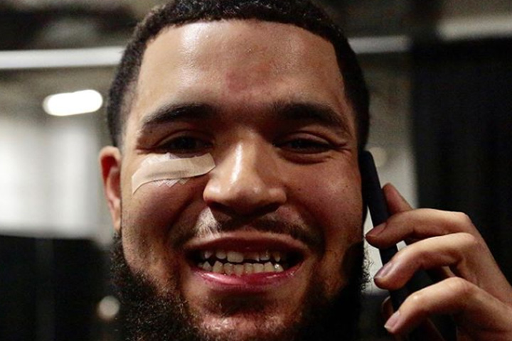 Toronto Raptors player Fred VanVleet shows off his broken smile after suffering an injury in Game 4 of the NBA Finals on June 7, 2019.