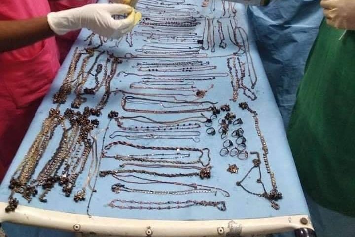 Doctors examine various metal objects found inside a patients stomach at Rampurhat Government Medical College and Hospital in India on July 24, 2019.