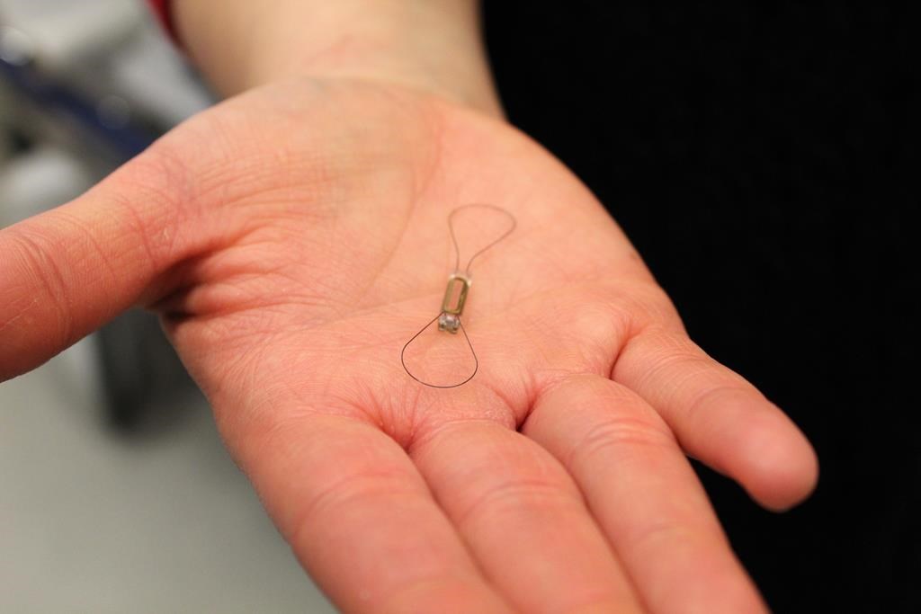 Tiny heart sensor giving Calgary doctors big advantage in ...