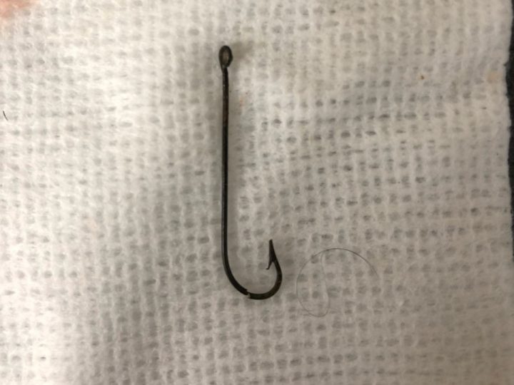 The hook, which is typically used for catching salmon, according to Dr. Oz.