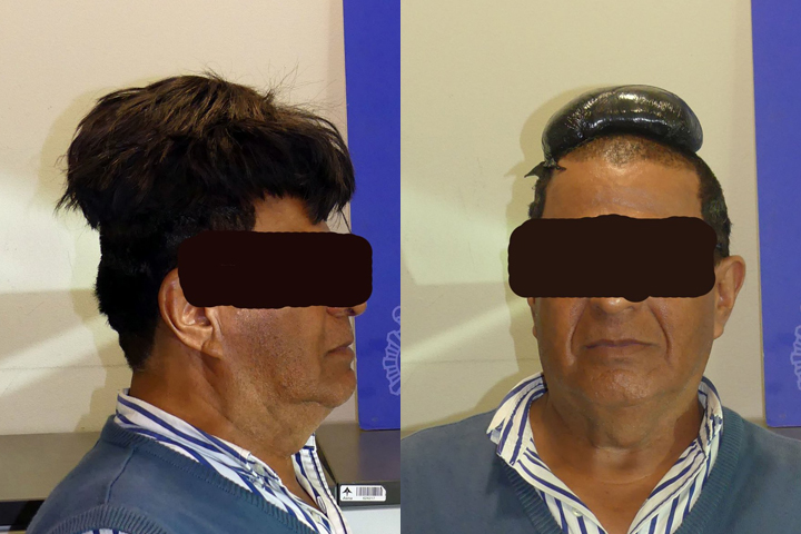 A man was detained at Barcelona airport in Spain after authorities noticed his oversized toupee, which concealed a packet of cocaine.