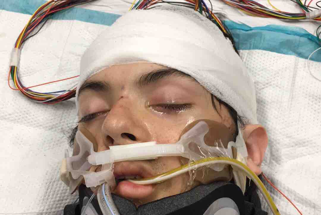 Abby Roby’s son, Tristan, lays in hospital recovering from injuries he sustained in a southwest London hit-and-run.