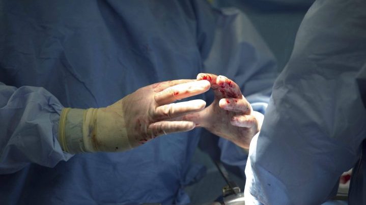 surgeons doctors gloves surgery operation hospital