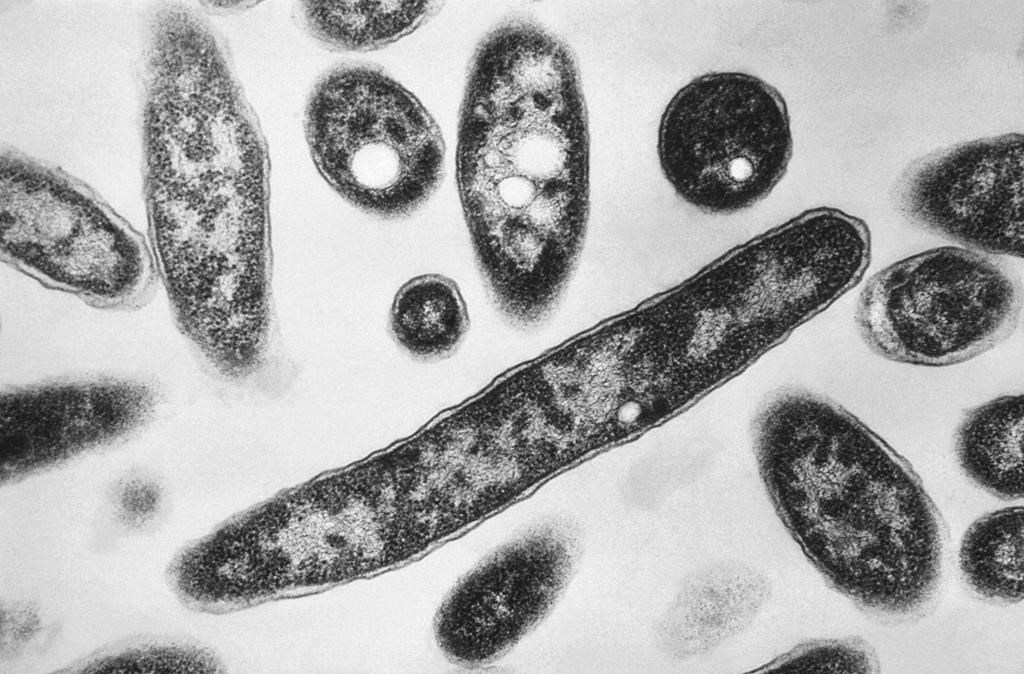 Legionella pneumophila bacteria.