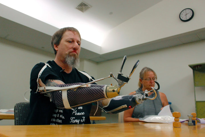 In this Aug. 19, 2019 photo, Greg Manteufel tries out a new prosthetic arm during occupational therapy at Froedtert & the Medical College of Wisconsin, in Milwaukee, as his wife Dawn Manteufel reads paperwork in the background.