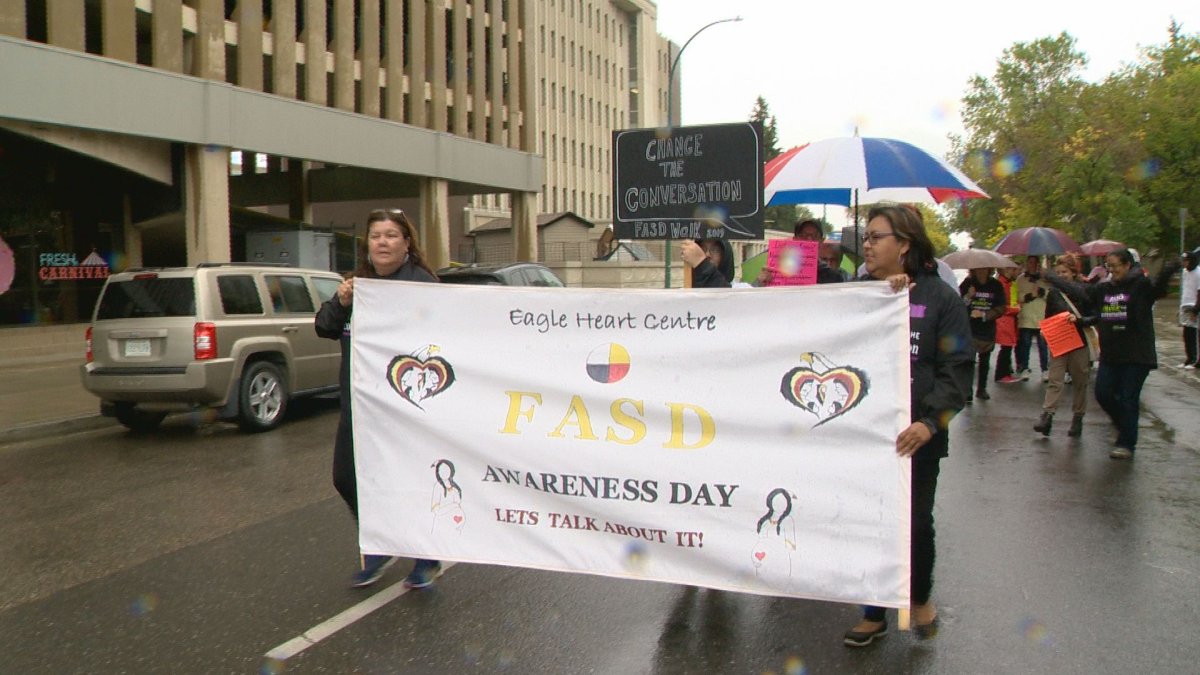 Raising awareness about FASD in Regina - image