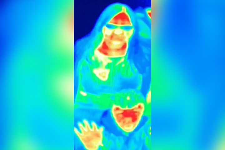 A thermal image of a woman that made her think she should get tested for breast cancer.