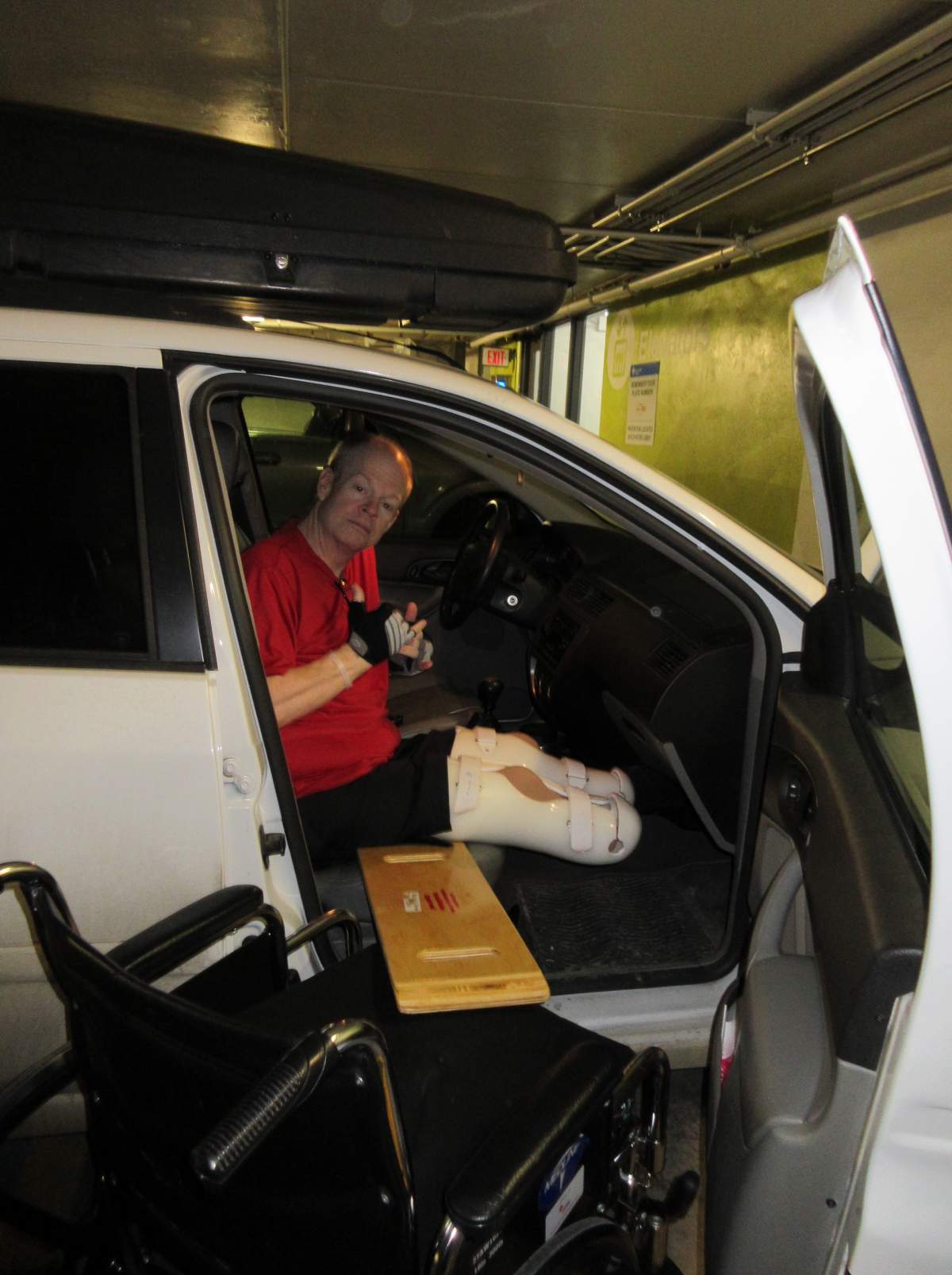 Ward after the double amputation surgery.