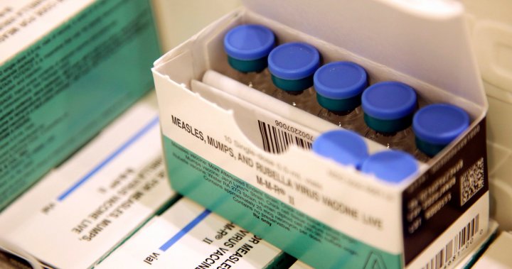 Отделът за обществено здравеопазване в района на Кингстън призовава за ваксини срещу морбили след докладвани случаи в Онтарио
